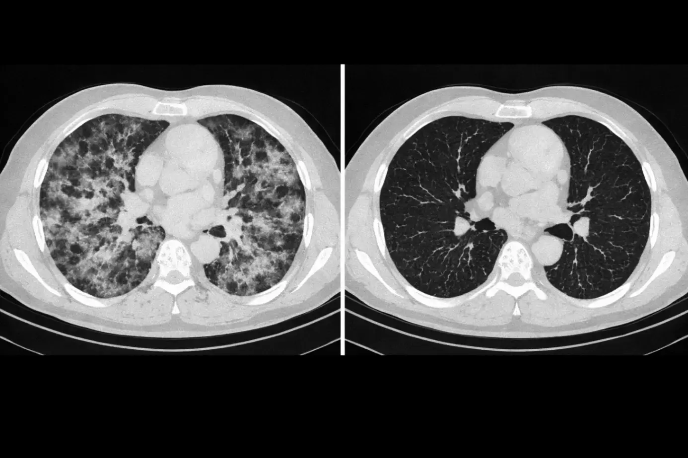 Раннее выявление изменений