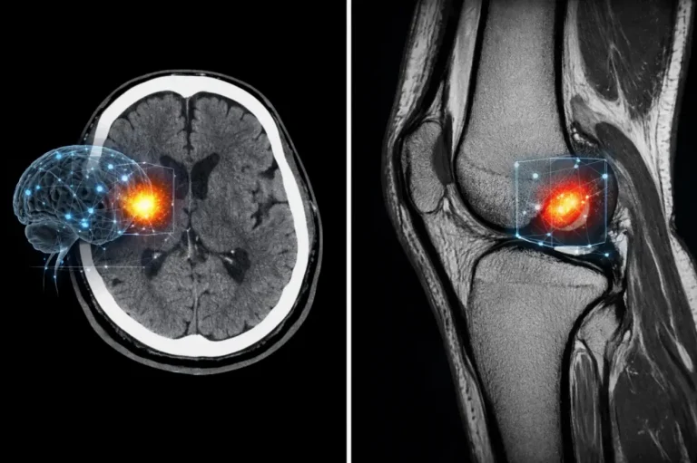 ИИ в КТ и МРТ: ранние изменения на снимках